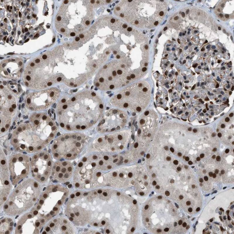 Staining of human kidney shows moderate to strong nuclear positivity in cells in tubules.