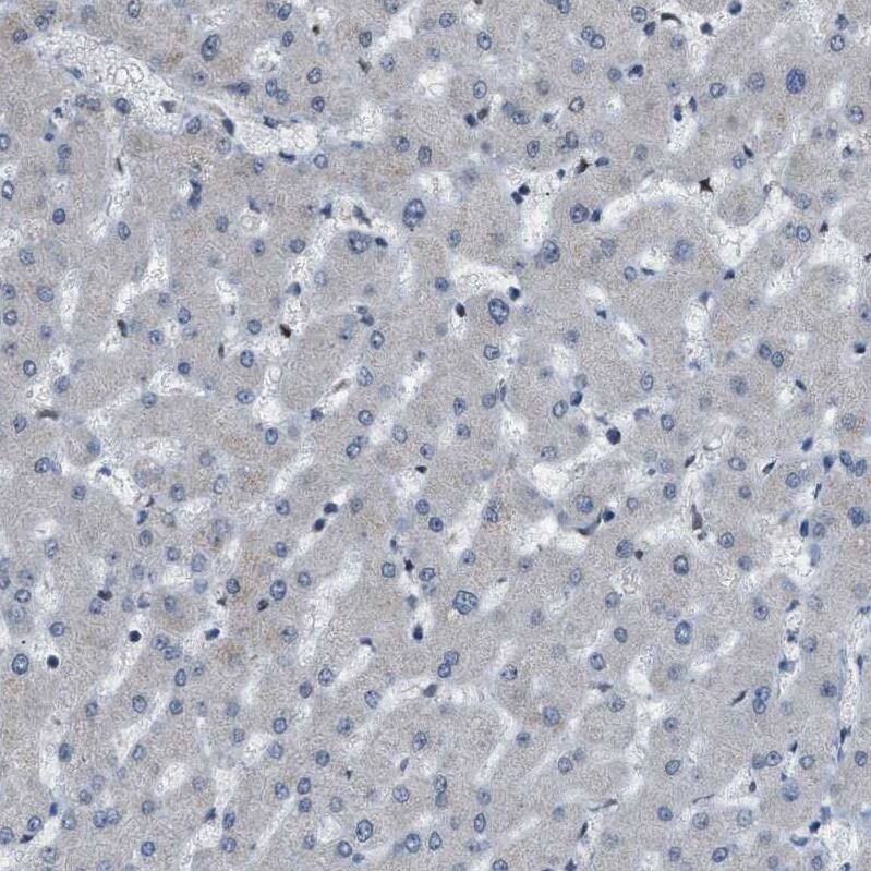 Staining of human liver shows no positivity as expected.