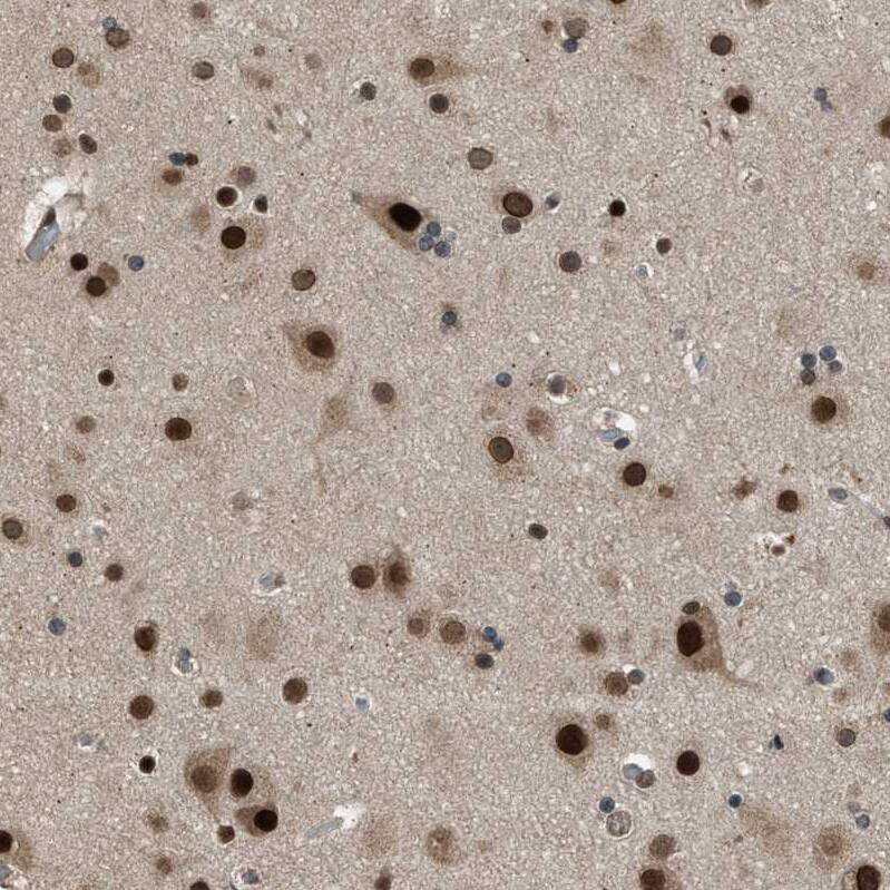 Staining of human cerebral cortex shows moderate to strong nuclear and cytoplasmic positivity in neurons.