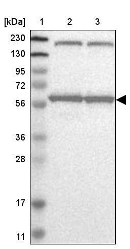 Lane 1: Marker [kDa] 230, 130, 95, 72, 56, 36, 28, 17, 11Lane 2: Human cell line RT-4Lane 3: Human cell line U-251MG sp