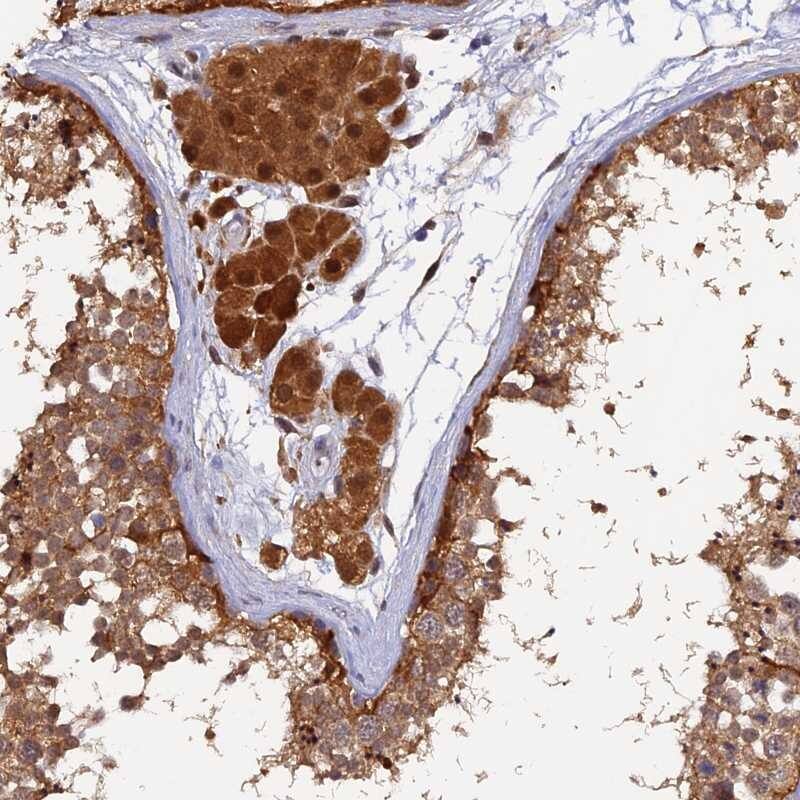 Staining of human testis shows strong cytoplasmic positivity in cells in seminiferus ducts while Leydig cells displayed strong cytoplasmic and nuclear staining.