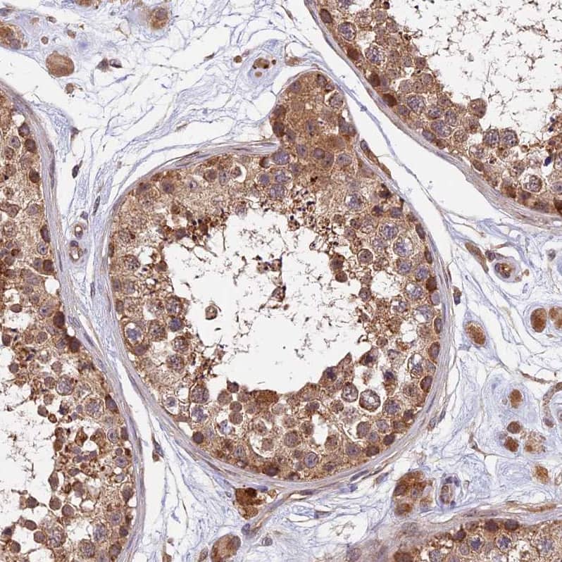 Staining of human testis shows strong cytoplasmic positivity in cells in seminiferous ducts.