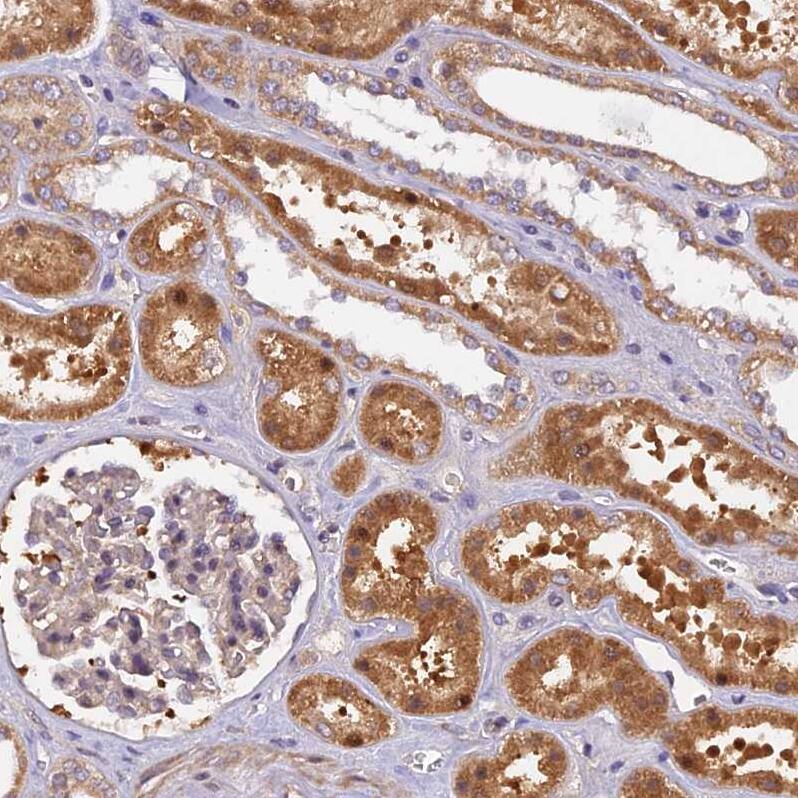 Staining of human kidney shows strong cytoplasmic positivity in cells in tubules.