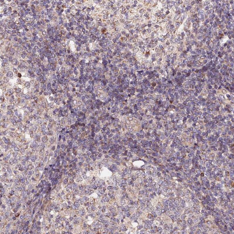Staining of human lymphoid tissues shows negative to very weak cytoplasmic positivity in non-germinal center cells.