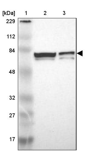 Lane 1: Marker [kDa] 229, 112, 84, 48, 32, 27, 17Lane 2: Human cell line RT-4Lane 3: Human cell line U-251MG sp
