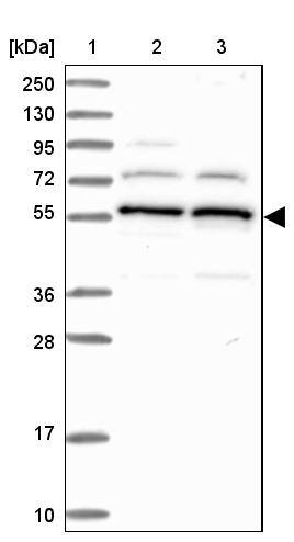 Lane 1: Marker [kDa] 250, 130, 95, 72, 55, 36, 28, 17, 10Lane 2: Human cell line RT-4Lane 3: Human cell line U-251MG sp