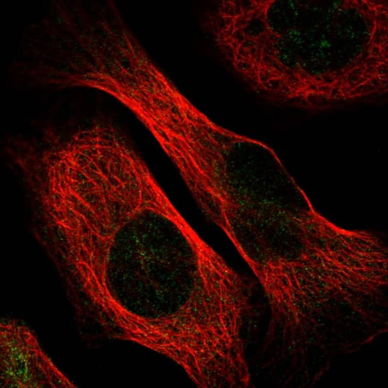 Staining of human cell line U-2 OS shows localization to nuclear membrane.