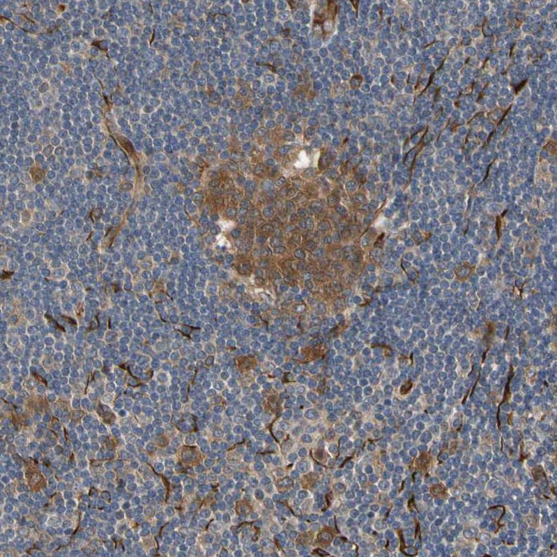 Immunohistochemistry-Paraffin FGD6 Antibody - BSA Free