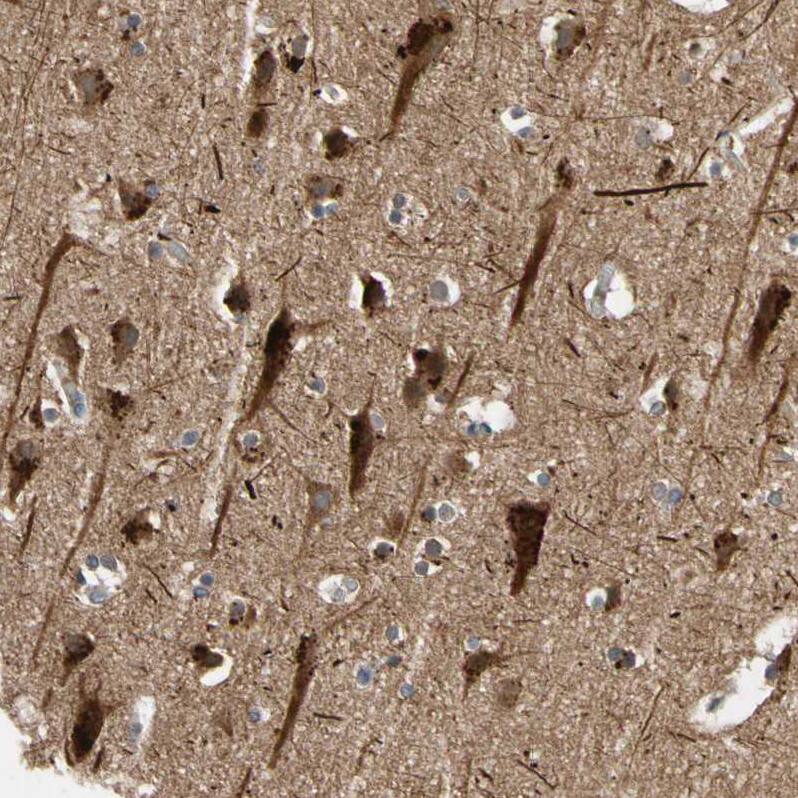 Immunohistochemistry-Paraffin FGD6 Antibody - BSA Free