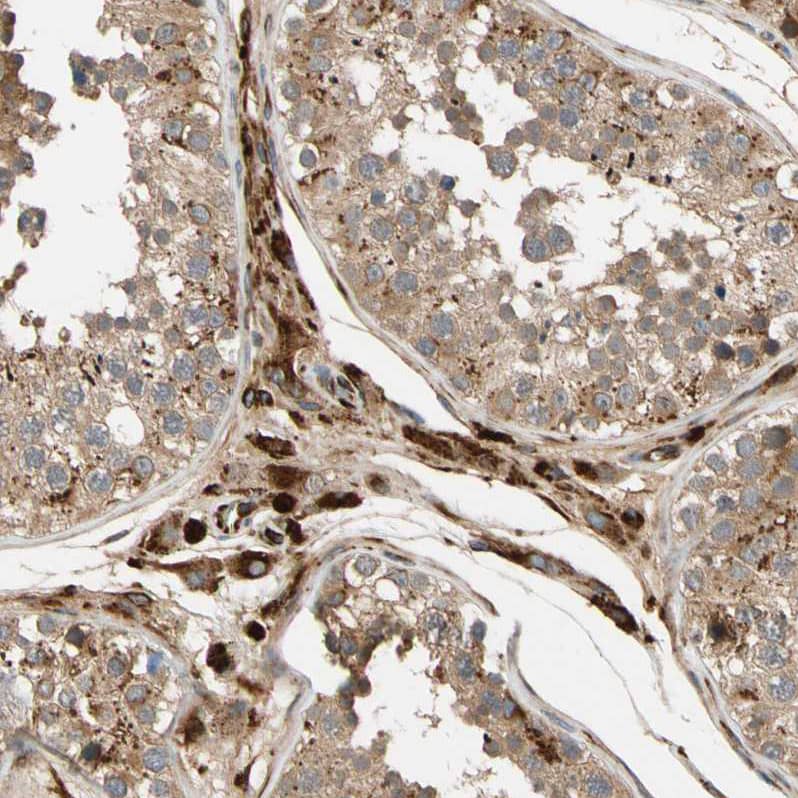 Immunohistochemistry-Paraffin FGD6 Antibody - BSA Free