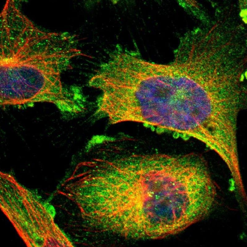 Staining of human cell line U-251 MG shows localization to plasma membrane & cytosol.