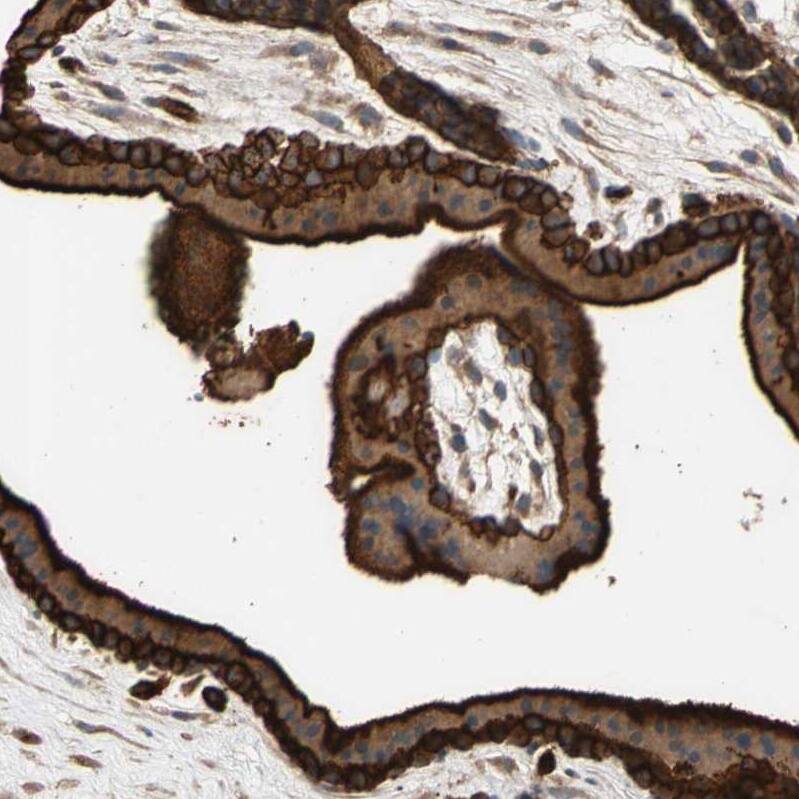 Staining of human placenta shows strong membranous positivity in trophoblastic cells.