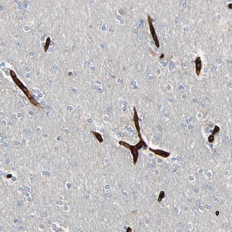 Staining of human cerebral cortex shows strong cytoplasmic positivity in endothelial cells.