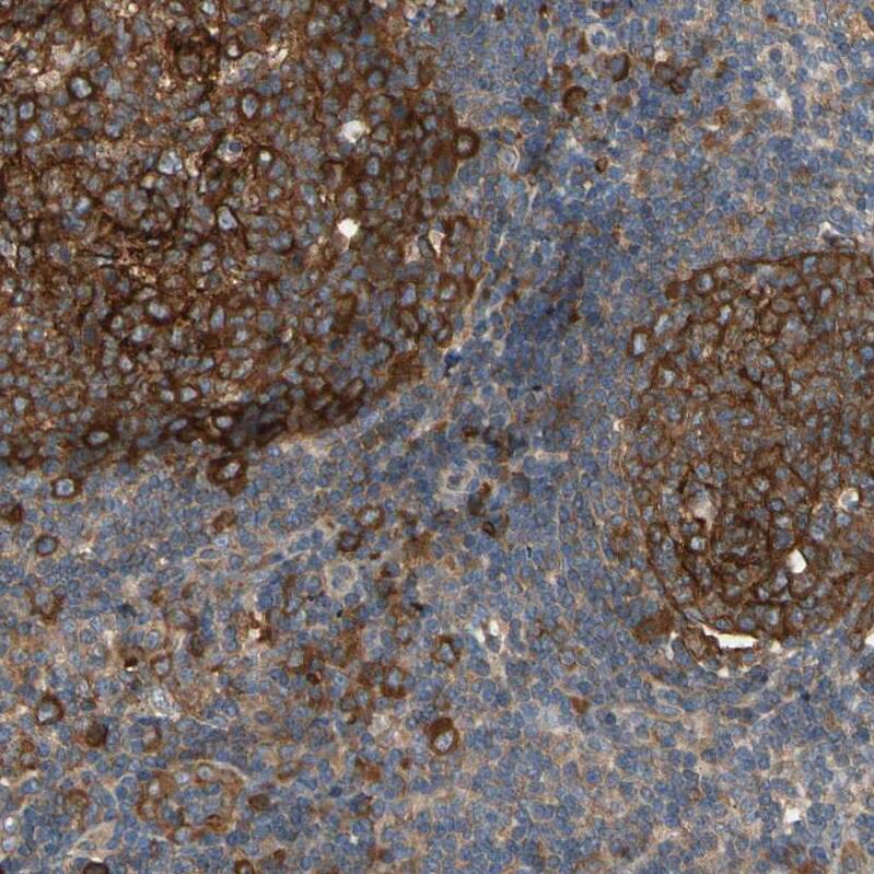 Staining of human tonsil shows strong cytoplasmic positivity in germinal center cells.