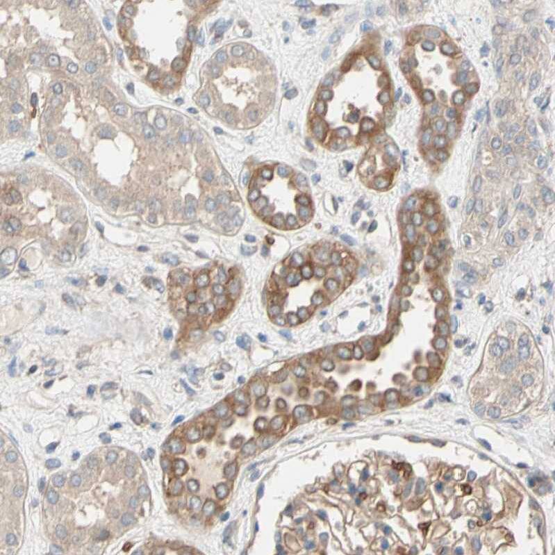 Staining of human kidney shows moderate membranous positivity in a subset of cells in tubules.
