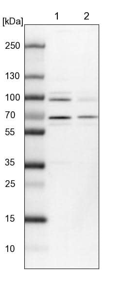 Lane 1: NIH-3T3 cell lysate (Mouse embryonic fibroblast cells))Lane 2: NBT-II cell lysate (Rat Wistar bladder tumour cells))