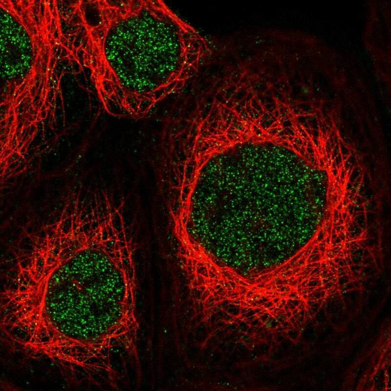 Staining of human cell line A-431 shows localization to nucleoplasm.