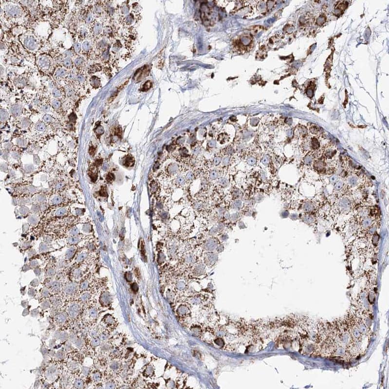 Staining of human testis shows moderate cytoplasmic granular positivity in cells in seminiferous ducts and leydig cells.