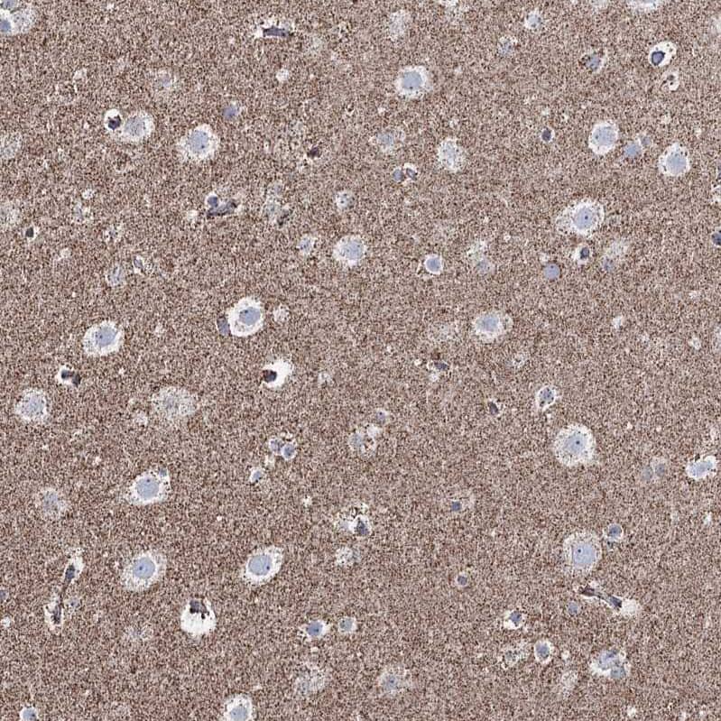 Immunohistochemistry-Paraffin CWF19L1 Antibody - BSA Free