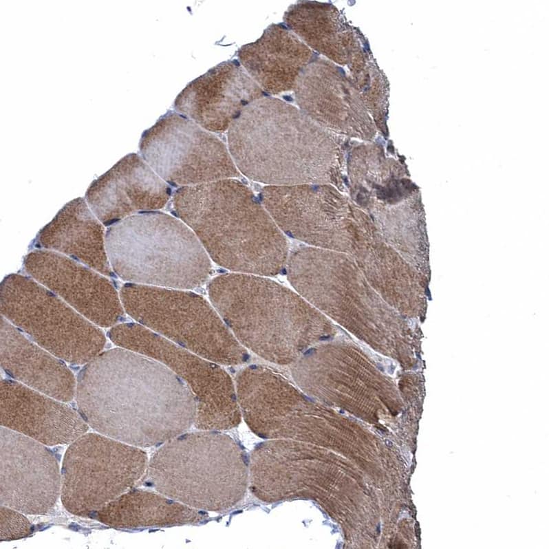 Immunohistochemistry-Paraffin FAM214A Antibody - BSA Free