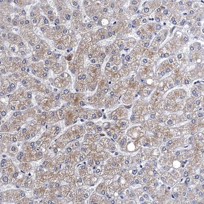 Immunohistochemistry-Paraffin FAM214A Antibody - BSA Free