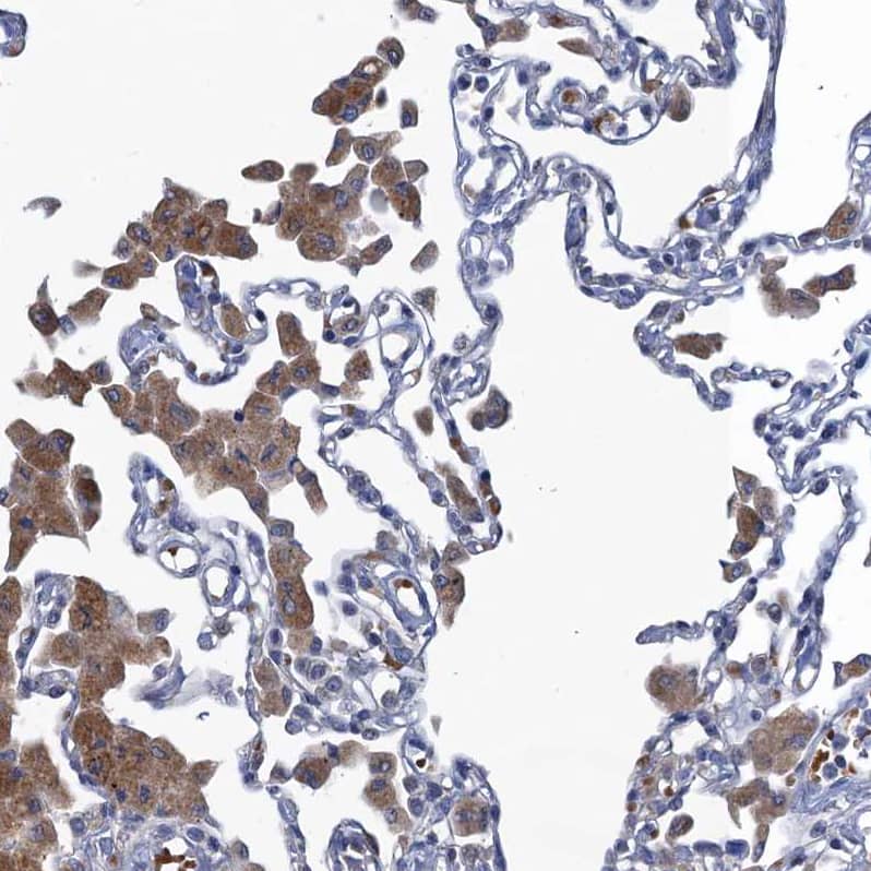 Immunohistochemistry-Paraffin FAM214A Antibody - BSA Free