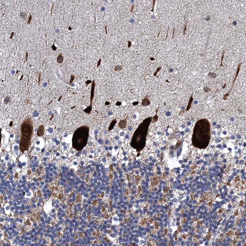 Immunohistochemistry-Paraffin FAM214A Antibody - BSA Free