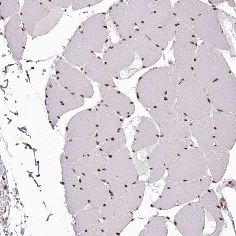 Staining of human skeletal muscle shows nuclear positivity in myocytes.