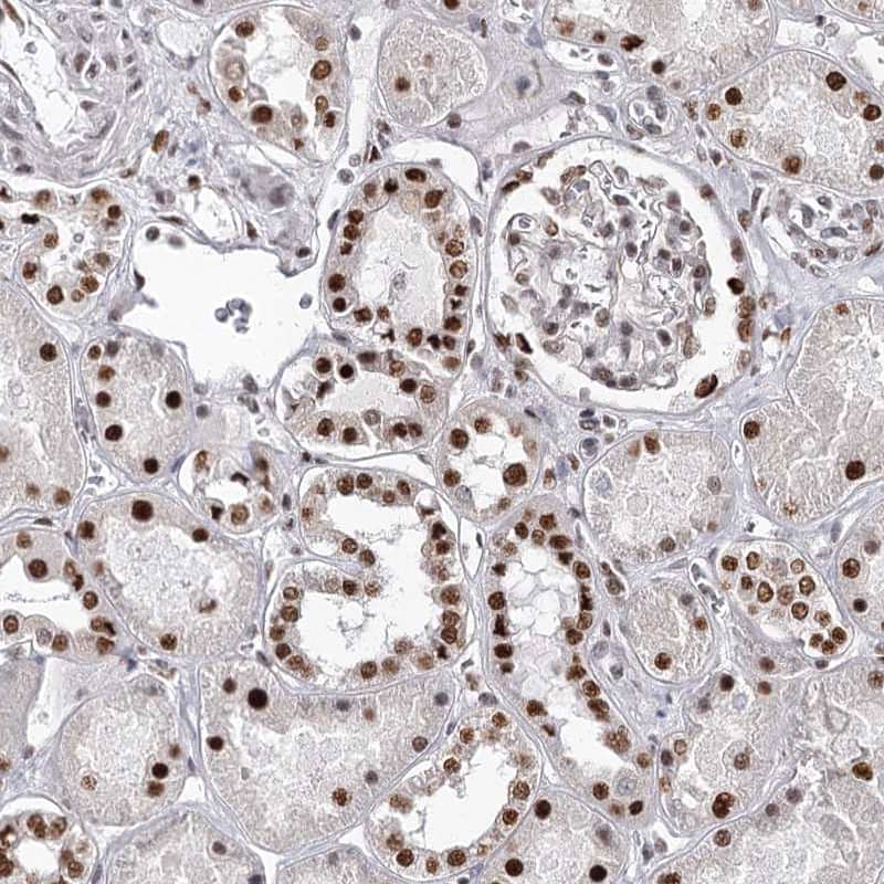 Staining of human kidney shows nuclear positivity in cells in tubules.