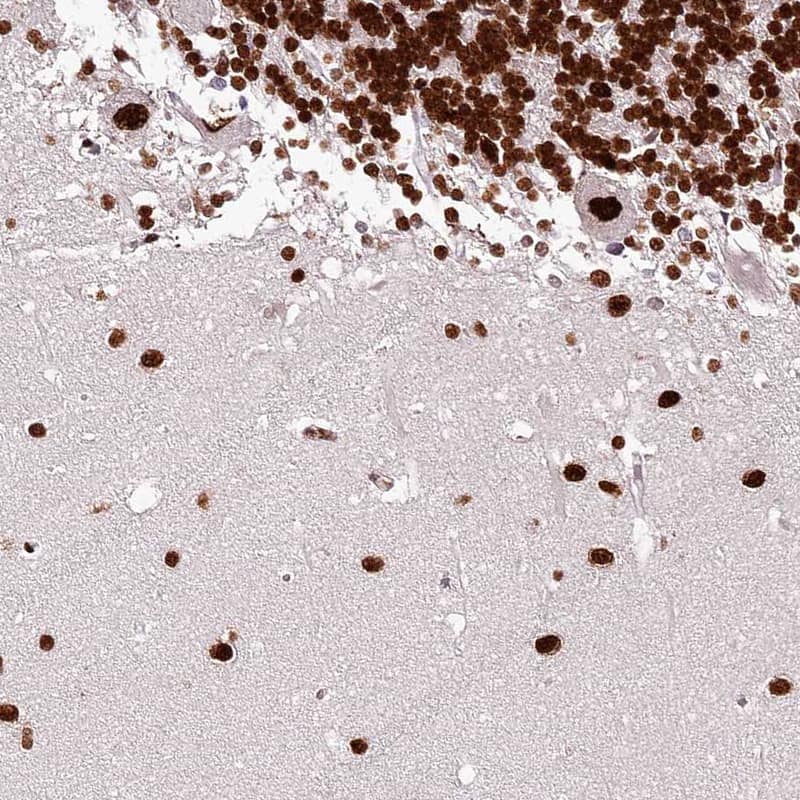 Staining of human cerebellum shows nuclear positivity.
