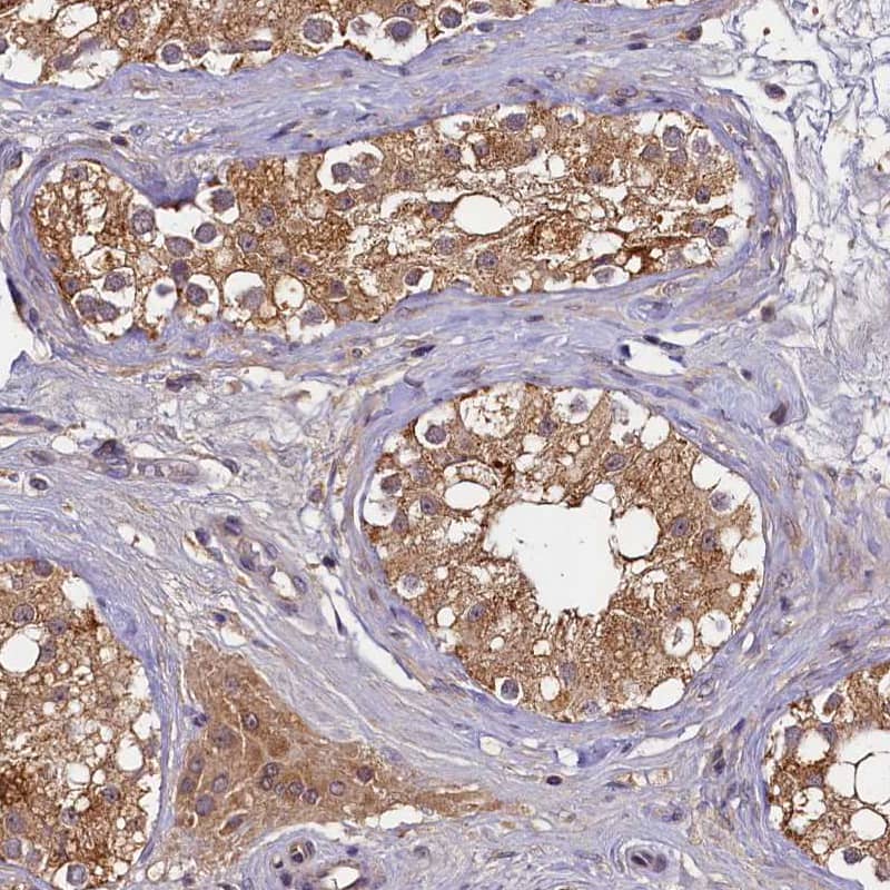 Immunohistochemistry-Paraffin TMEM39A Antibody - BSA Free
