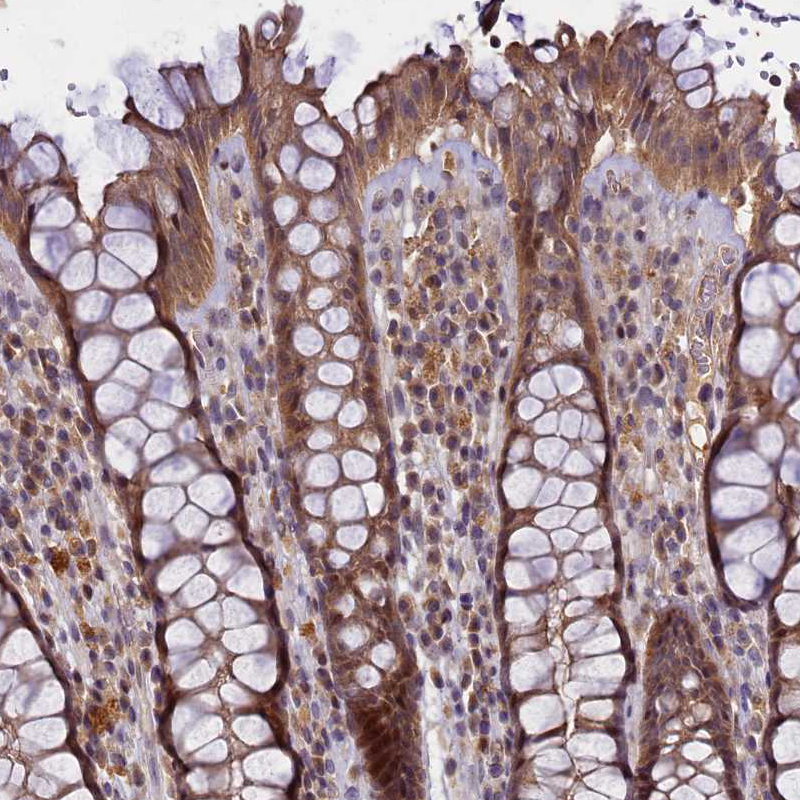 Immunohistochemistry-Paraffin TMEM39A Antibody - BSA Free