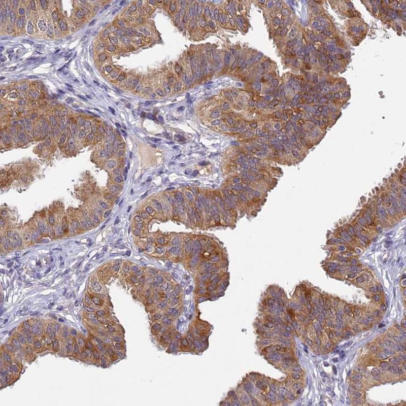 Staining of human fallopian tube shows moderate to strong granular cytoplasmic positivity in glandular cells.