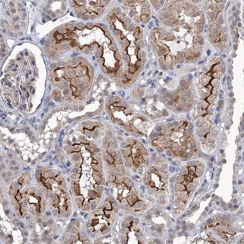 Staining of human kidney shows strong membranous positivity in cells in tubules.