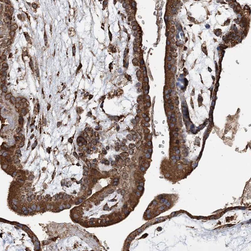 Immunohistochemistry-Paraffin WDR12 Antibody