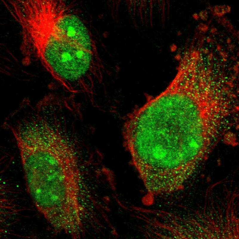 Staining of human cell line U-251 MG shows localization to nucleus, nucleoli & cytosol.