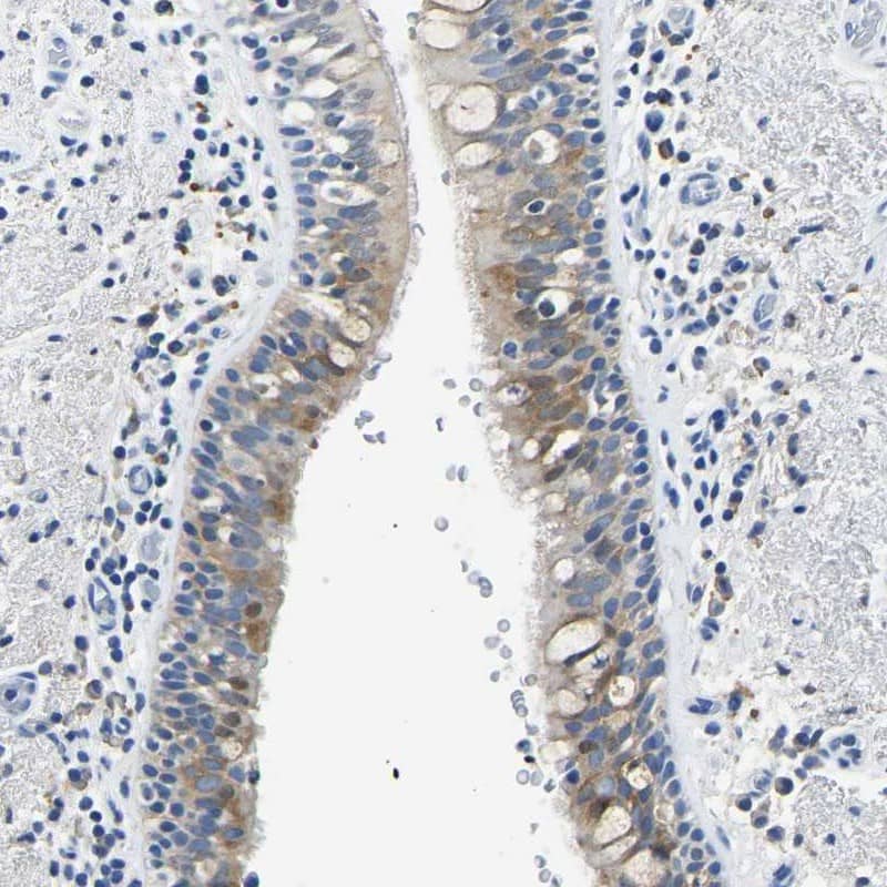 Staining of human bronchus shows moderate cytoplasmic positivity in respiratory epithelial cells.