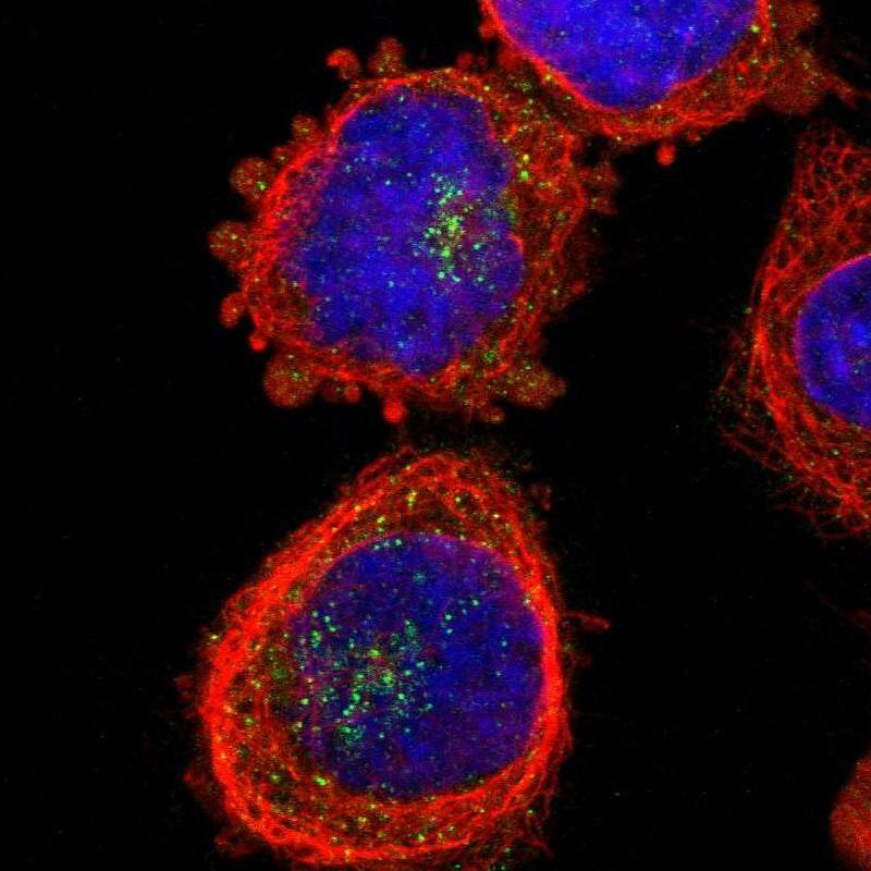 Staining of human cell line A-431 shows localization to the Golgi apparatus & vesicles.