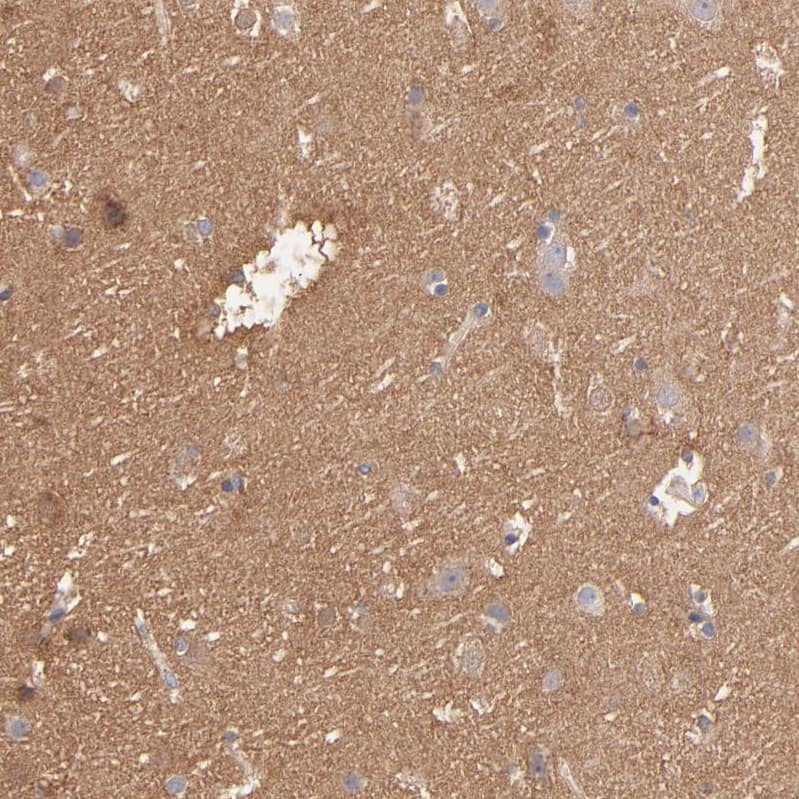 Staining of human cerebral cortex shows moderate cytoplasmic positivity in neuropil.