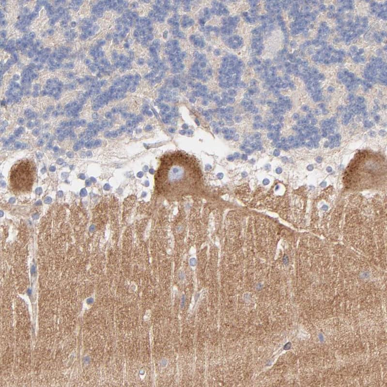 Staining of human cerebellum shows moderate cytoplasmic positivity in Purkinje cells.