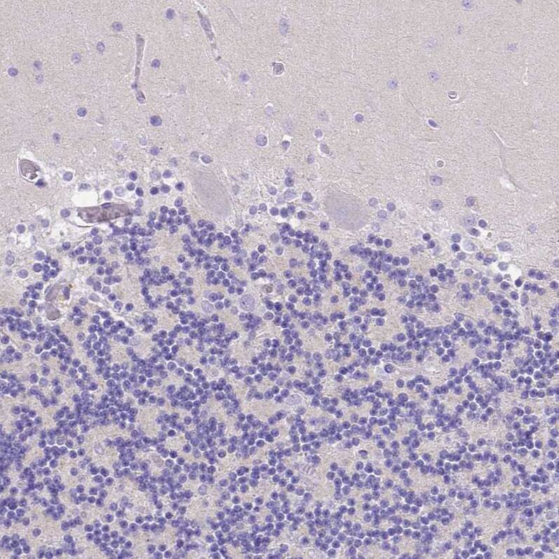Staining of human cerebellum shows no positivity in Purkinje cells as expected.