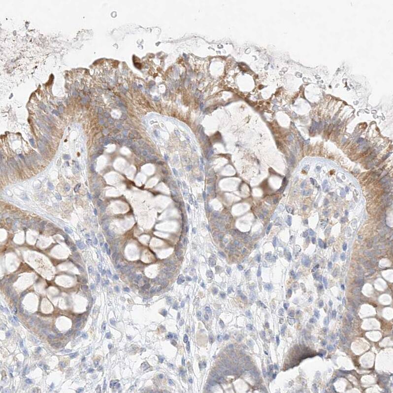 Staining of human colon shows moderate to strong cytoplasmic positivity in glandular cells).