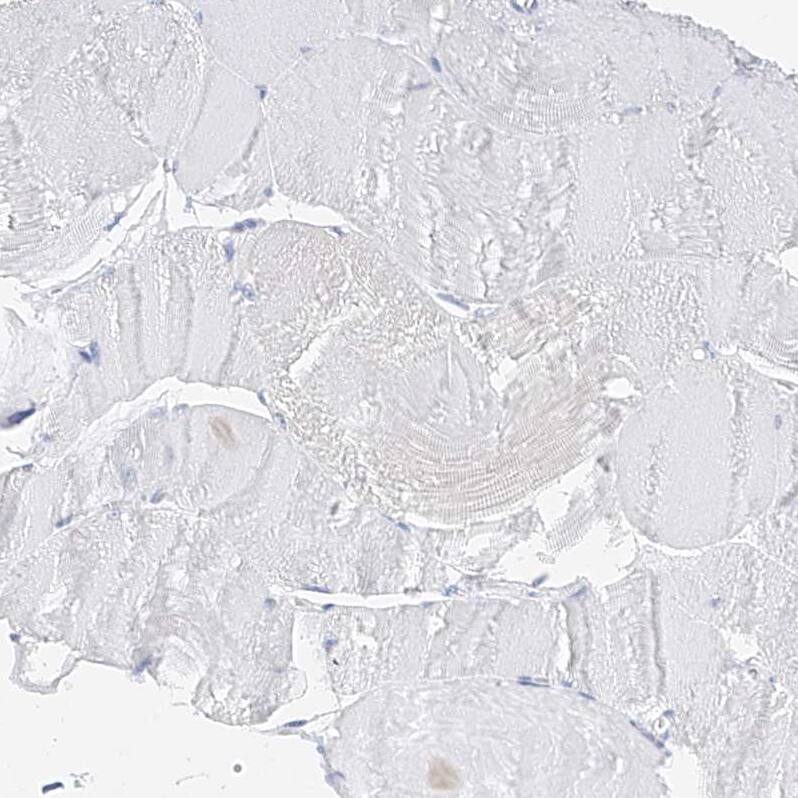 Staining of human skeletal muscle shows no positivity in myocytes.