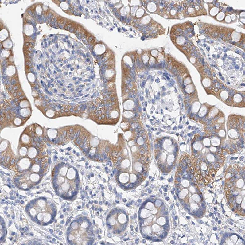 Staining of human small intestine shows moderate cytoplasmic positivity in glandular cells.