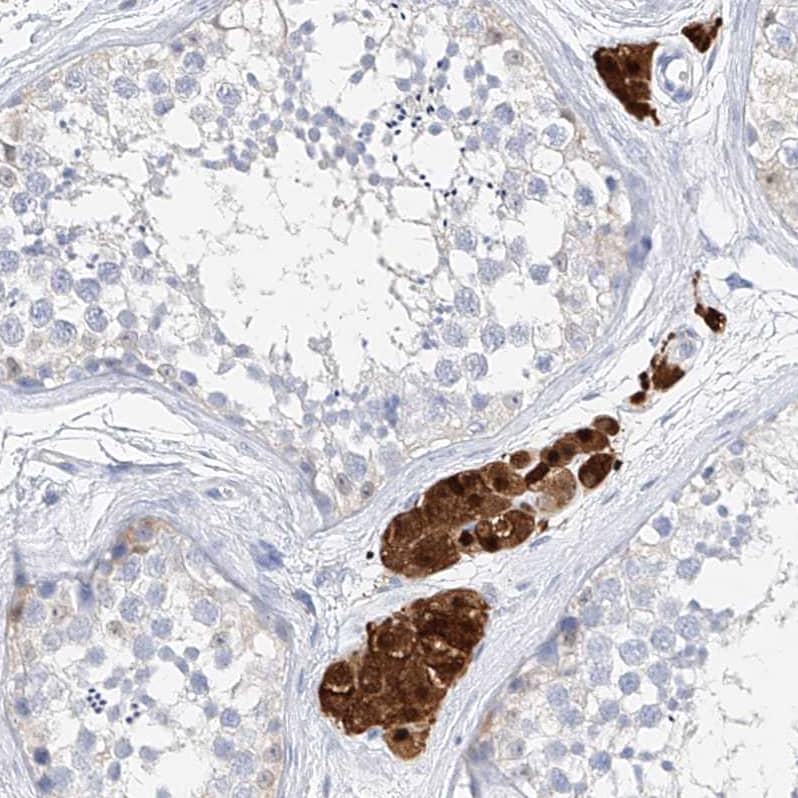 Staining of human testis shows strong nuclear and cytoplasmic positivity in Leydig cells.