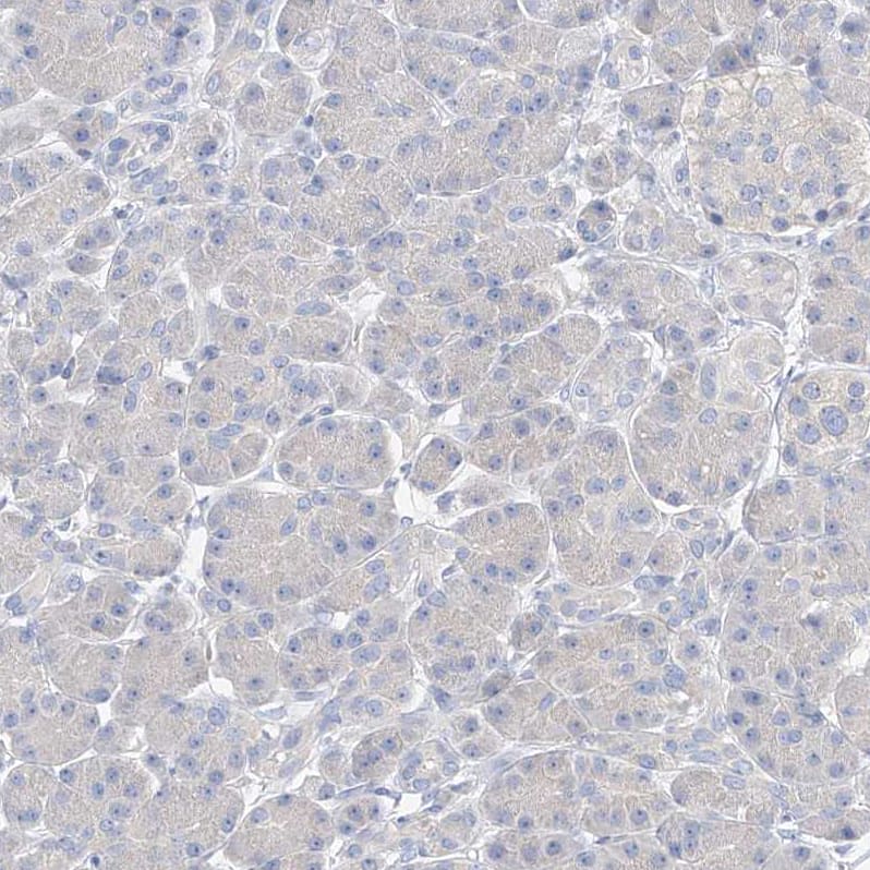 Staining of human pancreas shows no positivity in exocrine glandular cells.