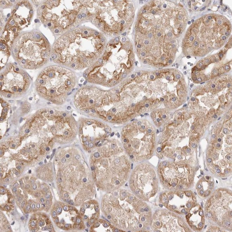 Immunohistochemistry-Paraffin PANK4 Antibody - BSA Free