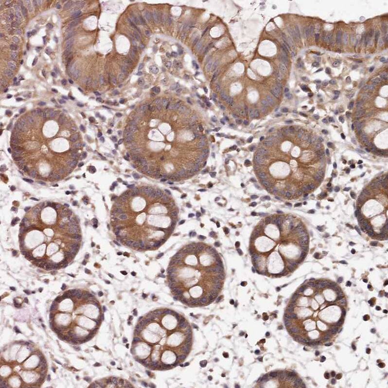 Immunohistochemistry-Paraffin PANK4 Antibody - BSA Free
