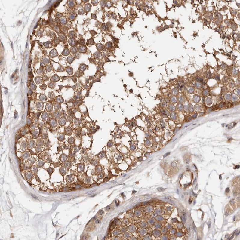 Immunohistochemistry-Paraffin PANK4 Antibody - BSA Free