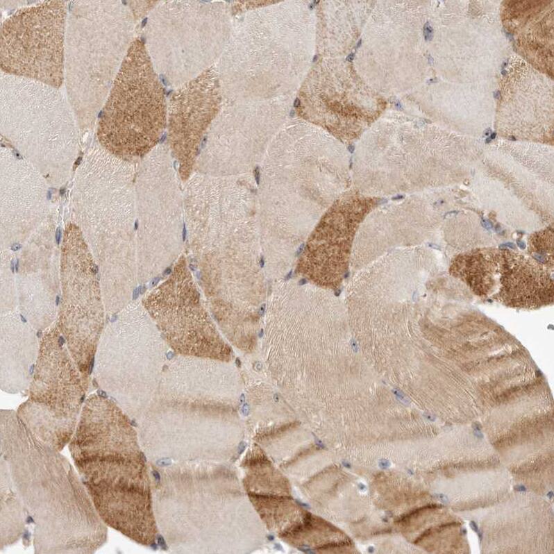 Immunohistochemistry-Paraffin PANK4 Antibody - BSA Free